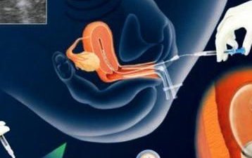 广东十大试管婴儿医院